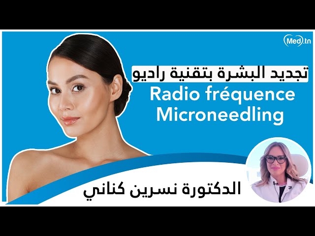 Video La radiofréquence pour le visage et le microneedling