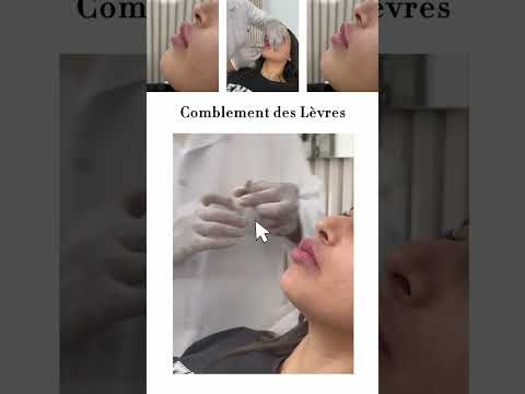 Video Glamour Clinic