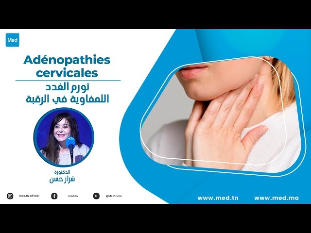 Video Adénopathies cervicales