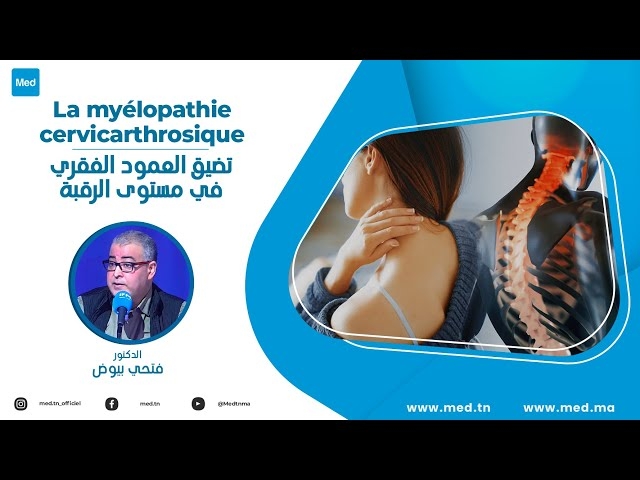 Video La myélopathie cervicarthrosique
