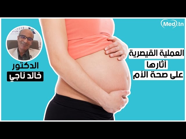 فيديو العملية القيصرية و آثارها على صحة الأم 