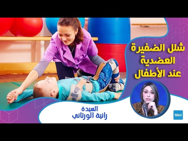 Video شلل الضفيرة العضدية عند الاطفال