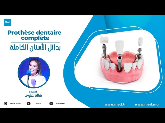 Video Prothèse dentaire complète
