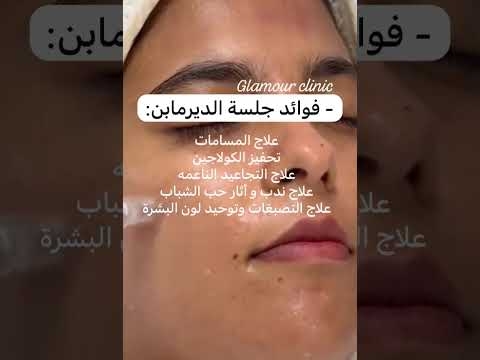 Video La mésothérapie