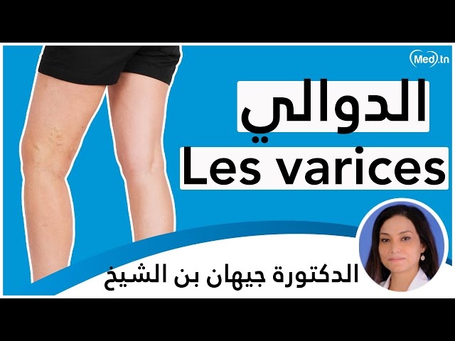 فيديو Les Varices 
