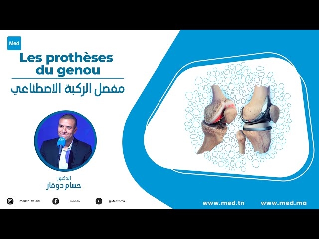 Video Les prothèses du genou