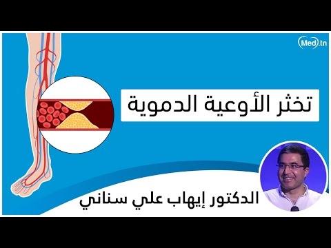 فيديو تخثر الأوعية الدموية