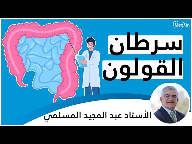 فيديو cancer du colon