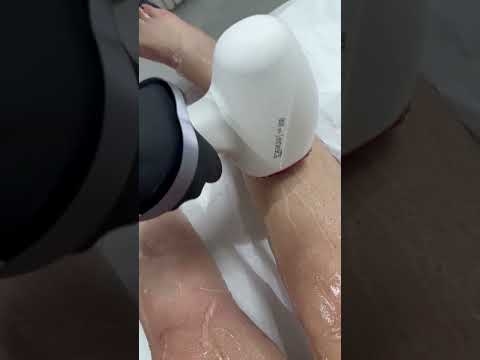 Video Épilation laser & épilation définitive pour tout type de peau  sans douleur