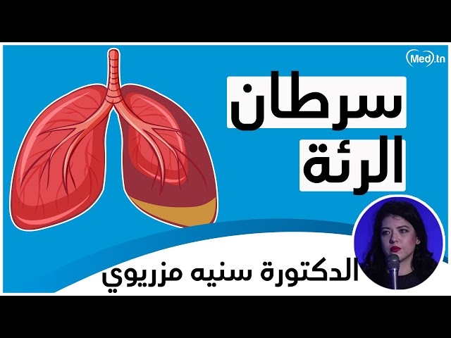 Video Cancer de poumon 