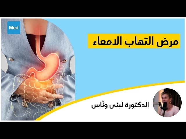 فيديو Maladie de Crohn -مرض التهاب الامعاء