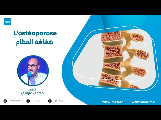 Video L'ostéoporose 