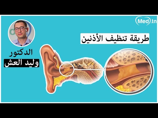فيديو طريقة تنظيف الأذنين
