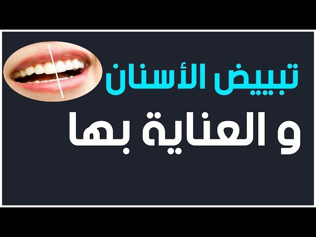 فيديو  تبييض الأسنان
