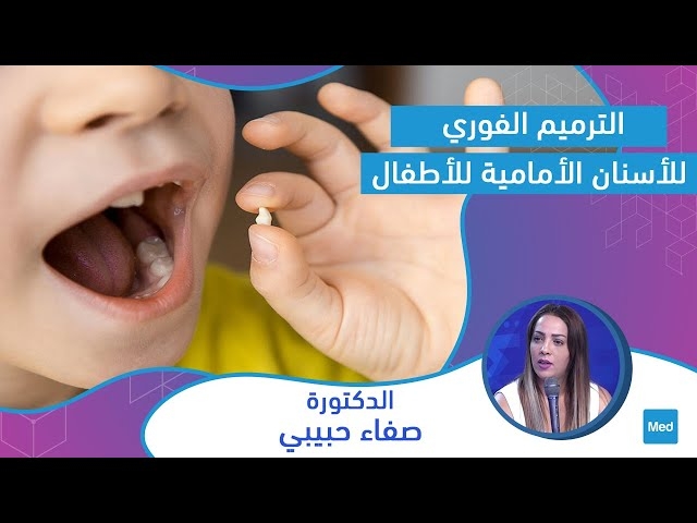 Video الترميم الفوري للأسنان الأمامية للأطفال
