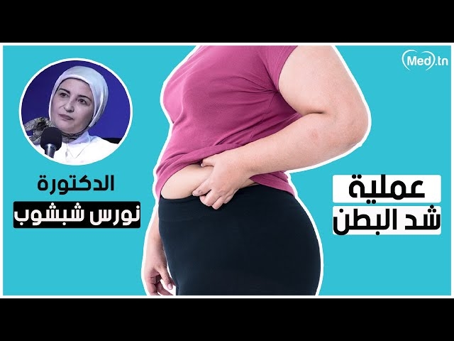 فيديو abdominoplasty