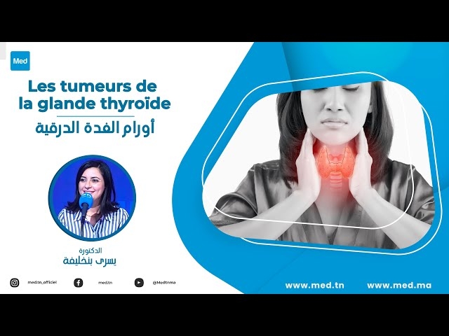 Video Les tumeurs de la glande thyroïde