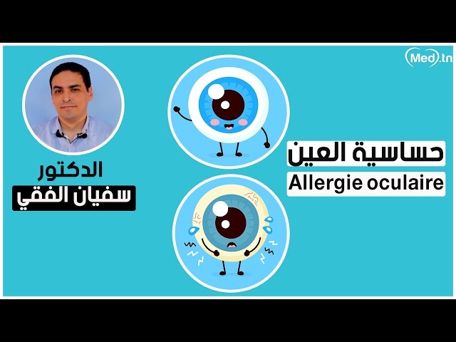 Video Allergie oculaire