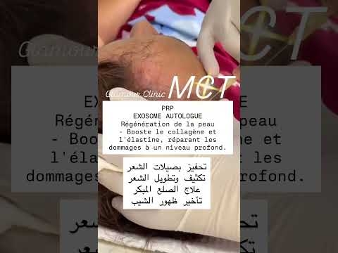 Video MCT