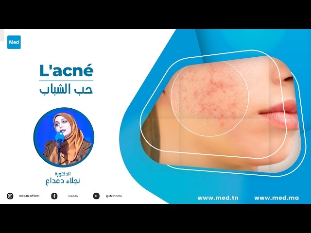 Video L'acné 