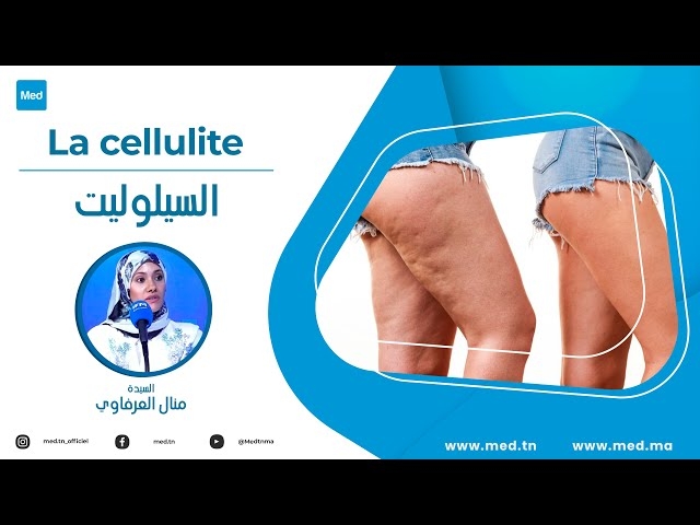 Video La cellulite