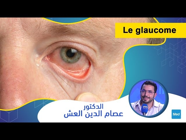 Video Le glaucome