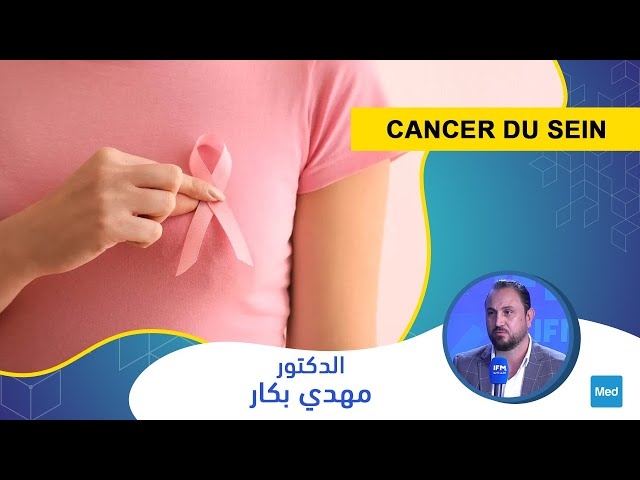 Video Cancer du sein