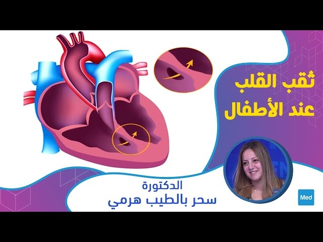 Video ثقب القلب عند الأطفال 