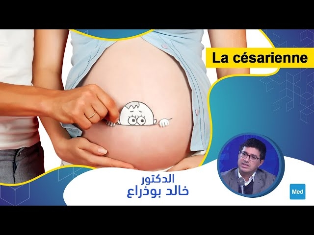 فيديو La césarienne