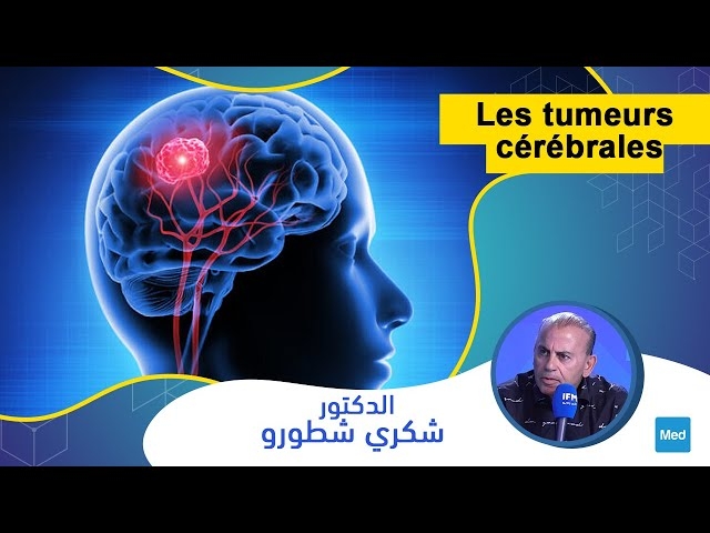 فيديو أورام الدماغ