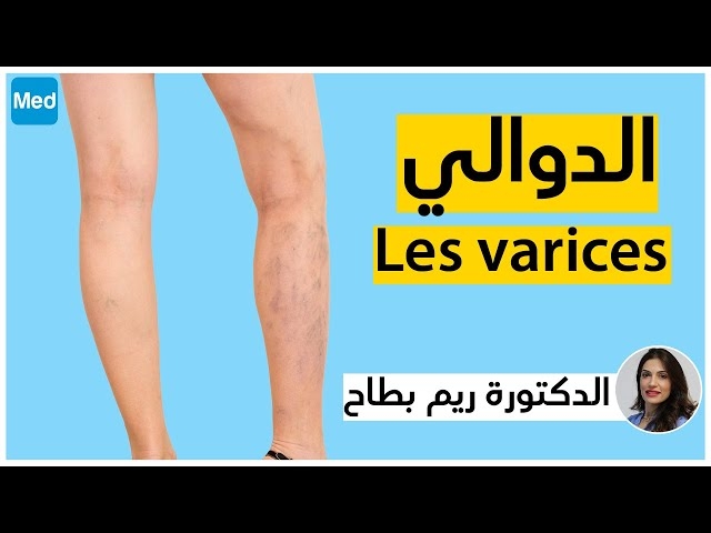 فيديو Les Varices 