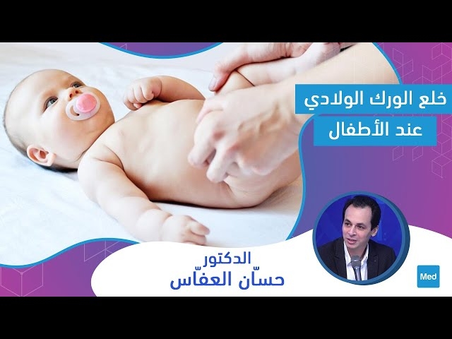 Video خلع الورك الولادي عند الأطفال