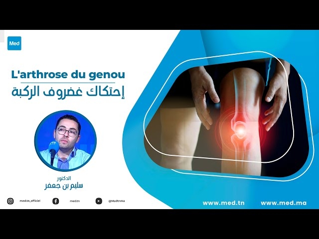 فيديو L'arthrose du genou