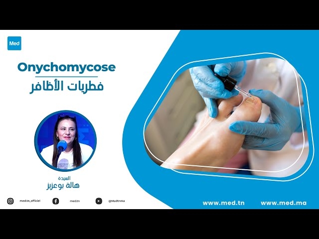 Video Onychomycose 
