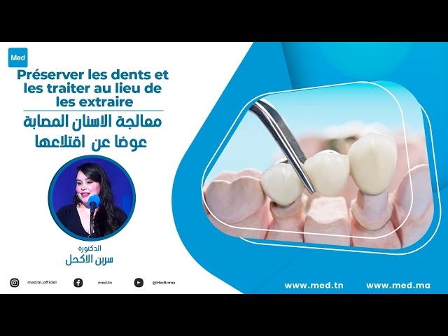 Video Préserver les dents et les traiter au lieu de les extraire