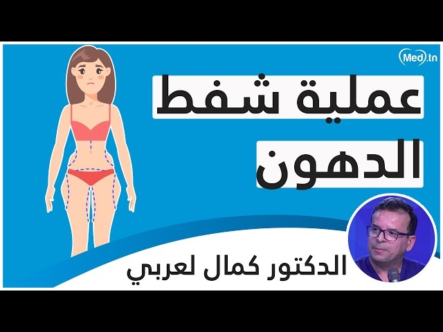 Video La liposuccion