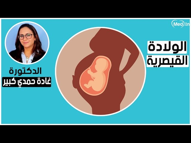 فيديو كم مرة يمكن للأم الخضوع للولادة القيصرية؟