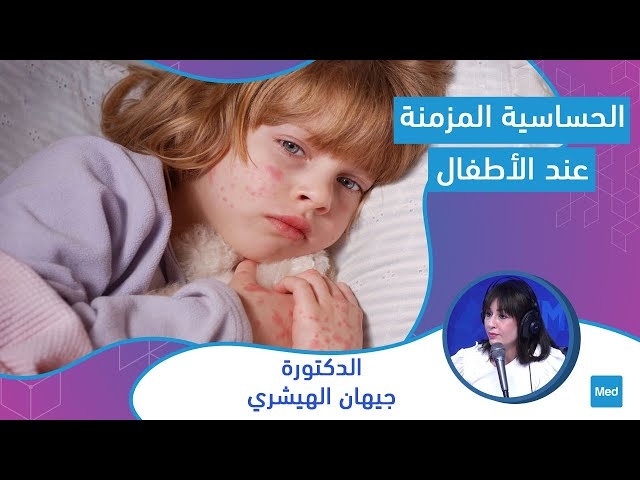 Video La dermatite atopique : الحساسية المزمنة عند الأطفال