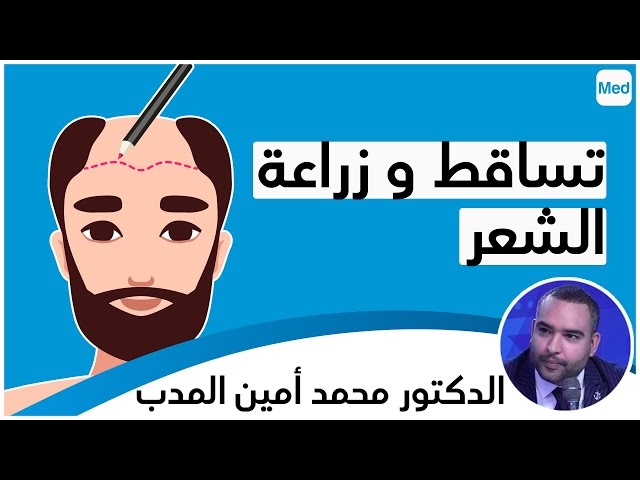 Video Greffe de cheveux  plus qu'un acte en médecine esthétique        