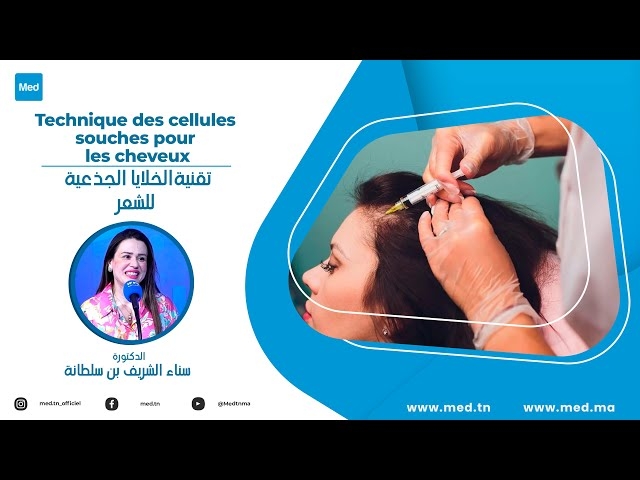 Video Technique des cellules souches pour les cheveux 