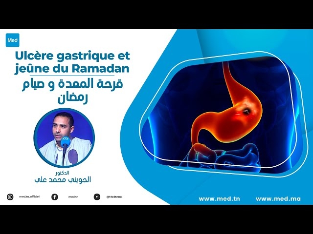 Video Ulcère gastrique et jeûne du Ramadan