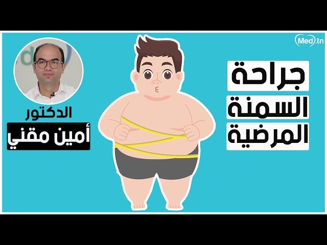 Video Chirurgie de l'obésité morbide 