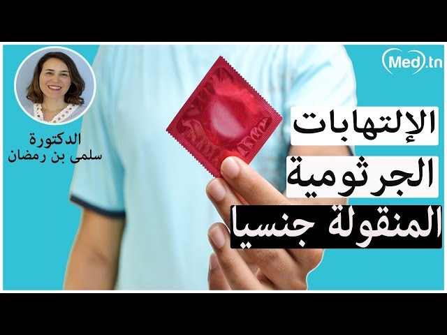 Video  les infections sexuellement transmissibles