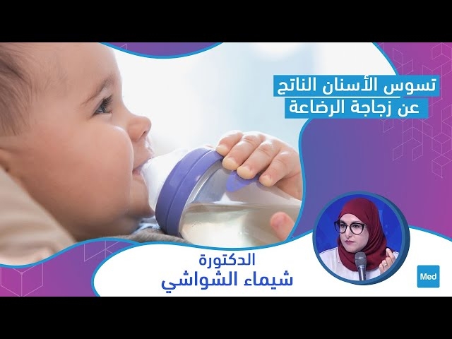 فيديو تسوس الأسنان الناتج عن زجاجة الرضاعة