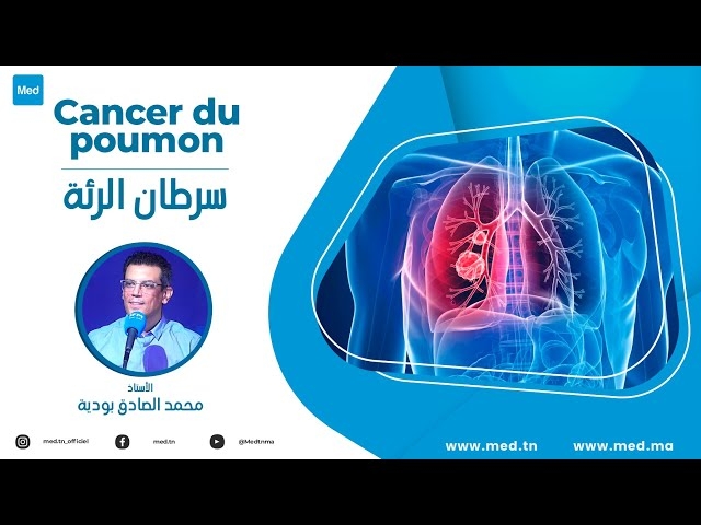 فيديو سرطان الرئة 