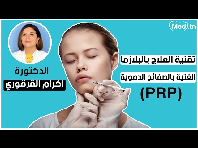 Video L'injection de PRP