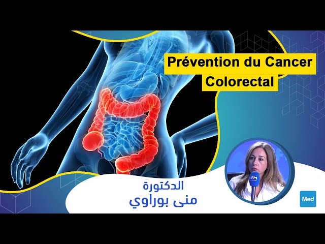 Video Prévention du cancer colorectal