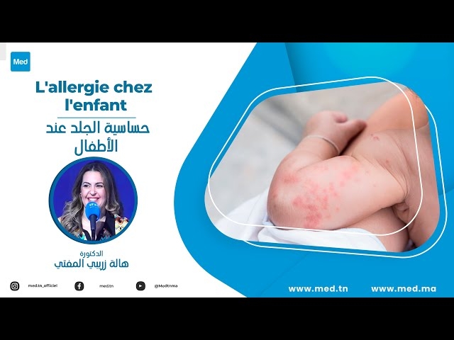 Video Allergie cutanée chez l’enfan