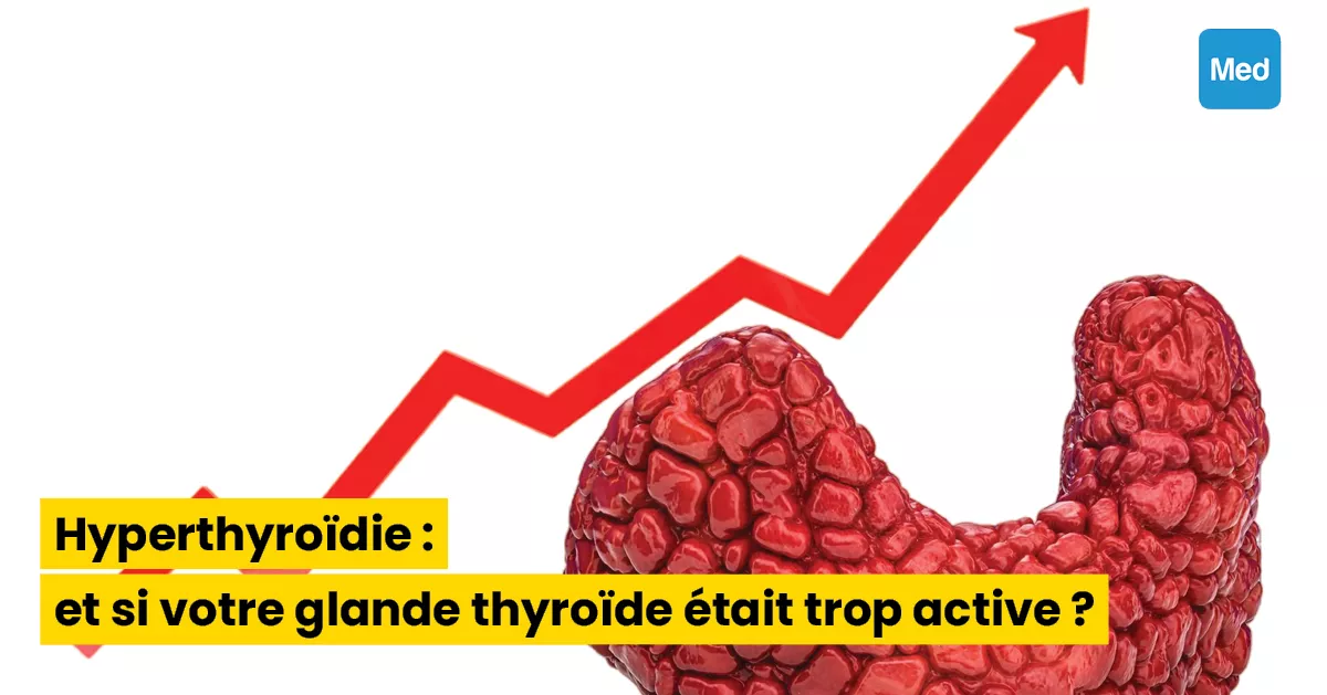 Hyperthyroïdie : et si votre glande thyroïde était trop active ?