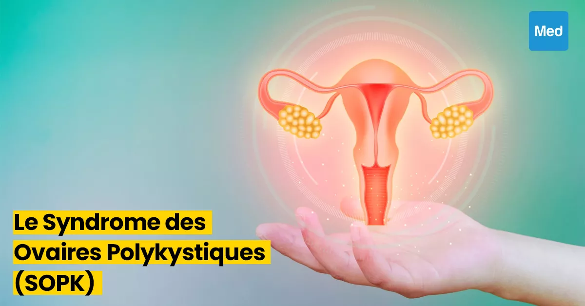 Syndrome des ovaire polykystiques (SOPK) – Gyneco-FIV